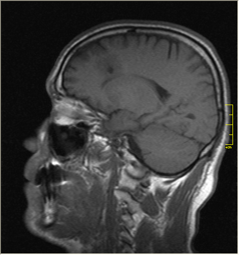 http://commons.wikimedia.org/wiki/File:Brain\_MRI\_131666.png